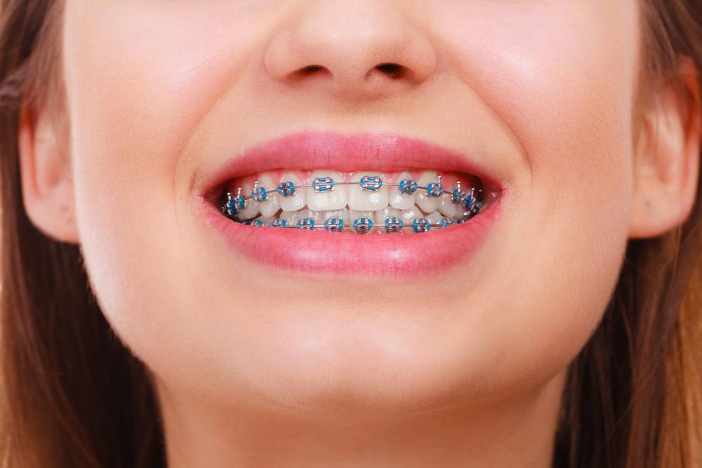 Orthodontics