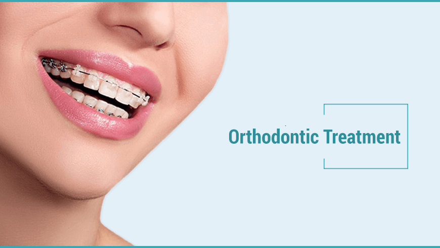 Orthodontic Treatment