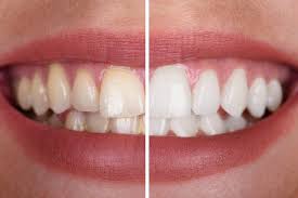 dentist doctor in Patel Nagar